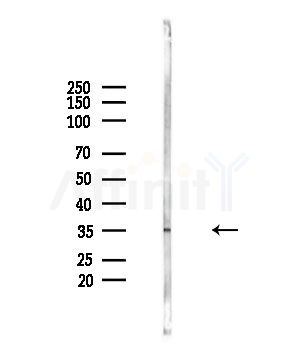 MAGEB5 Antibody - Western blot analysis of lysates from Mouse brain, using MAGEB5 Antibody at 1/1000 dilution.
