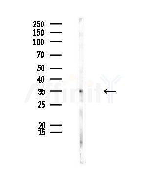 MAGEB5 Antibody - Western blot analysis of lysates from Rat liver, using MAGEB5 Antibody at 1/1000 dilution.