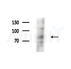NUAK2 Antibody - Western blot analysis of extracts from B16F10-LUC cells(starvation,24h treatment), using NUAK2 Antibody at 1/1000 dilution.