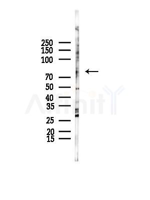 NUAK2 Antibody - Western blot analysis of lysates from B16F10-LUC cells(starvation,24h treatment), using NUAK2 Antibody at 1/1000 dilution.