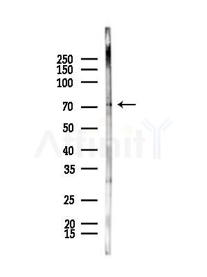 TNK1 Antibody - Western blot analysis of lysates from B16F10-LUC cells(starvation,24h treatment), using TNK1 Antibody at 1/1000 dilution.