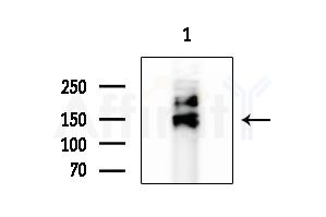 TTBK1 Antibody - Western blot analysis of extracts from Hela cells, using TTBK1 Antibody at 1/1000 dilution.