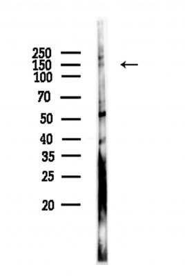 TTBK1 Antibody - Western blot analysis of lysates from Hela cells, using TTBK1 Antibody at 1/1000 dilution.