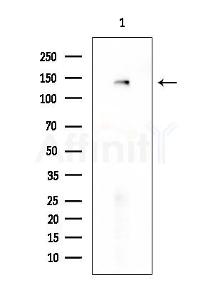 TTBK2 Antibody - Western blot analysis of extracts from Mouse liver, using TTBK2 Antibody at 1/1000 dilution.