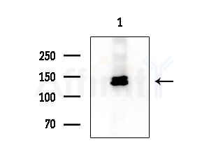 TTBK2 Antibody - Western blot analysis of extracts from Hela cells, using TTBK2 Antibody at 1/1000 dilution.