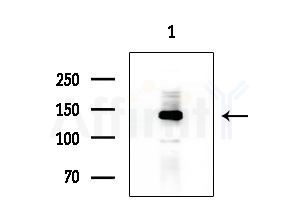 TTBK2 Antibody - Western blot analysis of extracts from HepG2 cells(lps 4h treatment), using TTBK2 Antibody at 1/1000 dilution.