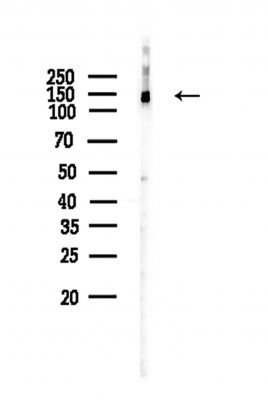 TTBK2 Antibody - Western blot analysis of lysates from Hela cells, using TTBK2 Antibody at 1/1000 dilution.
