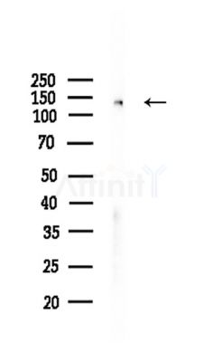 TTBK2 Antibody - Western blot analysis of lysates from Mouse liver, using TTBK2 Antibody at 1/1000 dilution.