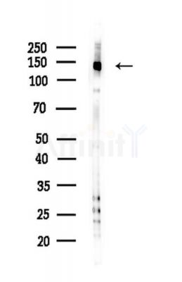TTBK2 Antibody - Western blot analysis of lysates from HepG2 cells(LPS,4h treatment), using TTBK2 Antibody at 1/1000 dilution.