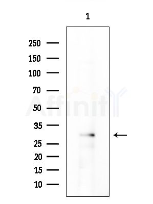 CEACAM3 Antibody - Western blot analysis of extracts from EC304 cells, using CEACAM3 Antibody at 1/1000 dilution.