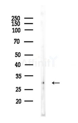 CEACAM3 Antibody - Western blot analysis of lysates from EC304 cells, using CEACAM3 Antibody at 1/1000 dilution.