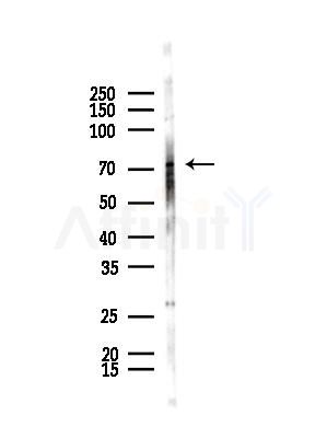 LRRN1 Antibody - Western blot analysis of lysates from B16F10-LUC cells(starvation,24h treatment), using LRRN1 Antibody at 1/1000 dilution.