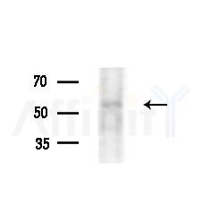 HTR3E Antibody - Western blot analysis of extracts from A375 cells(heat-shock,45min treatment), using HTR3E Antibody at 1/1000 dilution.