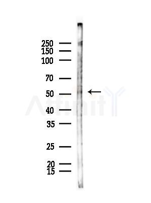HTR3E Antibody - Western blot analysis of lysates from B16F10-LUC cells(starvation,24h treatment), using HTR3E Antibody at 1/1000 dilution.