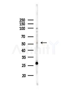 HTR3E Antibody - Western blot analysis of lysates from A375 cells(heat-shock,45min treatment), using HTR3E Antibody at 1/1000 dilution.