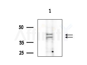 CMKLR1 Antibody - Western blot analysis of extracts from HepG2 cells(lps 4h treatment), using CMKLR1 Antibody at 1/1000 dilution.