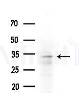 HOR5'Beta8 Antibody - Western blot analysis of extracts from HepG2 cells(heat-shock treatment), using HOR5'Beta8 Antibody at 1/1000 dilution.