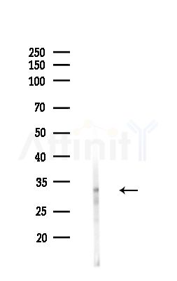 HOR5'Beta8 Antibody - Western blot analysis of lysates from HepG2 cells(heat-shock,45min treatment), using HOR5'Beta8 Antibody at 1/1000 dilution.