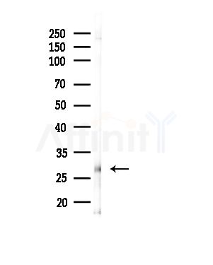 HOR5'Beta13 Antibody - Western blot analysis of lysates from RAW264.