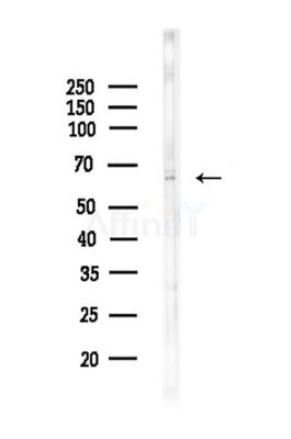 GPR133 Antibody - Western blot analysis of lysates from COLO205 cells, using GPR133 Antibody at 1/1000 dilution.