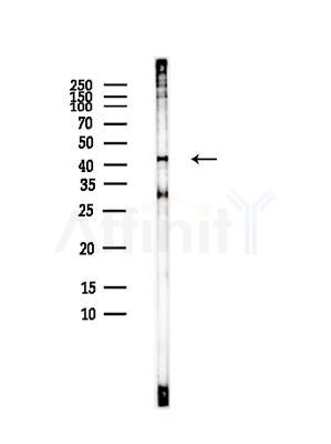 GPR21 Antibody - Western blot analysis of lysates from EC304 cells(heat-shock, 45min treatment), using GPR21 Antibody at 1/1000 dilution.