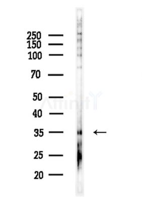 GPR35 Antibody - Western blot analysis of lysates from EC304 cells, using GPR35 Antibody at 1/1000 dilution.