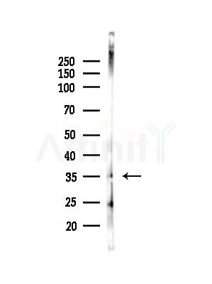 GPR7 Antibody - Western blot analysis of lysates from COLO205 cells(UV,30min treatment), using GPR7 Antibody at 1/1000 dilution.