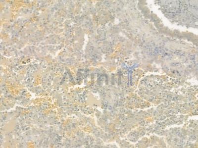 GPR78 Antibody - DF2763 at 1/100 staining human normal tonsil tissue by IHC-P.