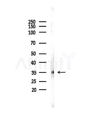 GPR8 Antibody - Western blot analysis of lysates from PC12 cells(heat-shock,45min treatment), using GPR8 Antibody at 1/1000 dilution.