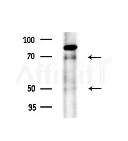 EBI2 Antibody - Western blot analysis of extracts from B16F10-LUC cells(starvation,24h treatment), using EBI2 Antibody at 1/1000 dilution.