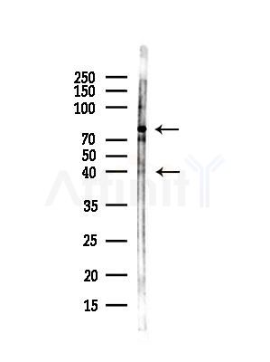 EBI2 Antibody - Western blot analysis of lysates from B16F10-LUC cells(starvation,24h treatment), using EBI2 Antibody at 1/1000 dilution.