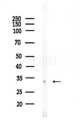 OR51M1 Antibody - Western blot analysis of lysates from EC304 cells, using OR51M1 Antibody at 1/1000 dilution.