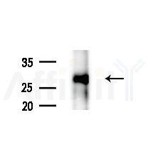 OR6C75 Antibody - Western blot analysis of extracts from B16F10-LUC cells(starvation treatment), using OR6C75 Antibody at 1/1000 dilution.