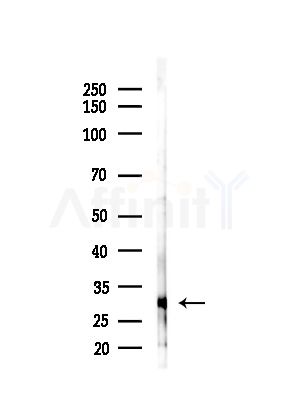 OR6C75 Antibody - Western blot analysis of lysates from B16F10-LUC cells(starvation,24h treatment), using OR6C75 Antibody at 1/1000 dilution.