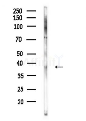 OR1G1 Antibody - Western blot analysis of lysates from HepG2 cells(LPS,4h treatment), using OR1G1 Antibody at 1/1000 dilution.