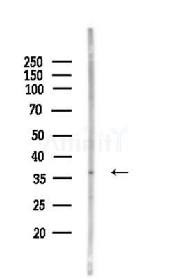 OR1G1 Antibody - Western blot analysis of lysates from Mouse liver, using OR1G1 Antibody at 1/1000 dilution.
