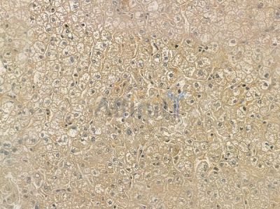 OR1I1 Antibody - DF2838 at 1/100 staining human normal liver tissue by IHC-P.