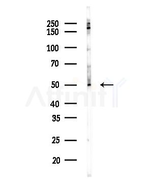 OR1J1 Antibody - Western blot analysis of lysates from COLO205 cells(heat-shock,45min treatment), using OR1J1 Antibody at 1/1000 dilution.