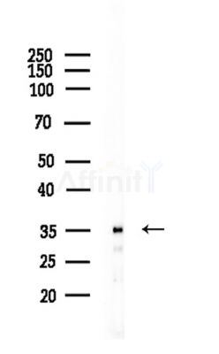 OR1L1 Antibody - Western blot analysis of lysates from EC304 cells, using OR1L1 Antibody at 1/1000 dilution.