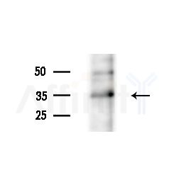 OR1L4/1L6 Antibody - Western blot analysis of extracts from HepG2 cells(UV treatment), using OR1L4/1L6 Antibody at 1/1000 dilution.