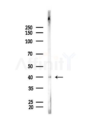 OR1L4/1L6 Antibody - Western blot analysis of lysates from B16F10-LUC cells(starvation,24h treatment), using OR1L4/1L6 Antibody at 1/1000 dilution.