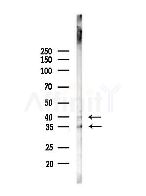 OR1L4/1L6 Antibody - Western blot analysis of lysates from HepG2 cells(UV treatment), using OR1L4/1L6 Antibody at 1/1000 dilution.