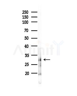 OR2A2 Antibody - Western blot analysis of lysates from RAW264.