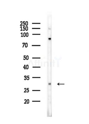 OR2H1 Antibody - Western blot analysis of lysates from EC304 cells, using OR2H1 Antibody at 1/1000 dilution.