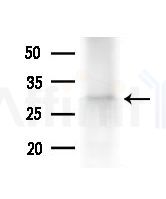 OR2L3/2L8 Antibody - Western blot analysis of extracts from PC12 cells(LPS,4h treatment), using OR2L3/2L8 Antibody at 1/1000 dilution.