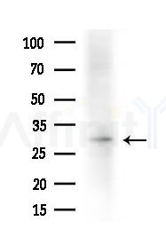 OR2L3/2L8 Antibody - Western blot analysis of extracts from HepG2 cells(heat-shock treatment), using OR2L3/2L8 Antibody at 1/1000 dilution.