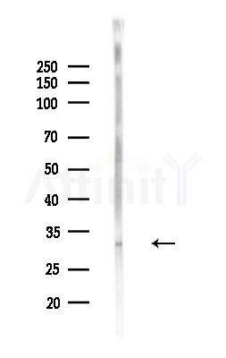 OR2L3/2L8 Antibody - Western blot analysis of lysates from PC12 cells(LPS,4h treatment), using OR2L3/2L8 Antibody at 1/1000 dilution.