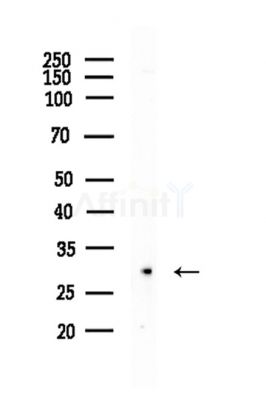 OR2L3/2L8 Antibody - Western blot analysis of lysates from EC304 cells, using OR2L3/2L8 Antibody at 1/1000 dilution.