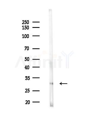 OR2M4 Antibody - Western blot analysis of lysates from Rat kidney, using OR2M4 Antibody at 1/1000 dilution.
