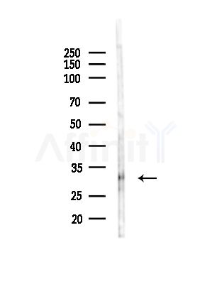 OR2T27 Antibody - Western blot analysis of lysates from PC12 cells(LPS,4h treatment), using OR2T27 Antibody at 1/1000 dilution.